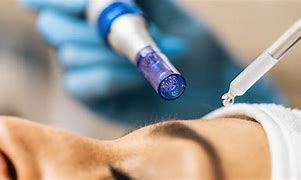 Collagen Induction Therapy