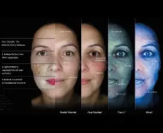 OBSERV 520x Skin Analysis Machine