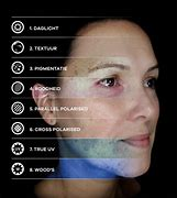 OBSERV 520x Technology Enhanced Skin Analysis